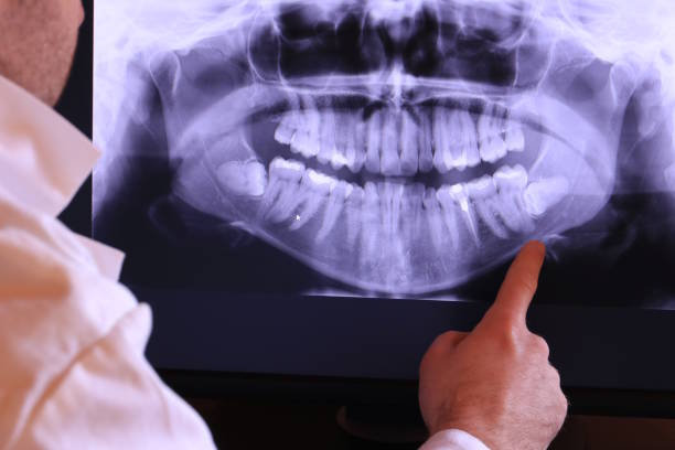 Best Broken Tooth Emergency  in Salado, TX