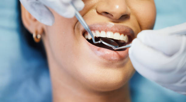 Best Affordable Emergency Dental Care  in Salado, TX